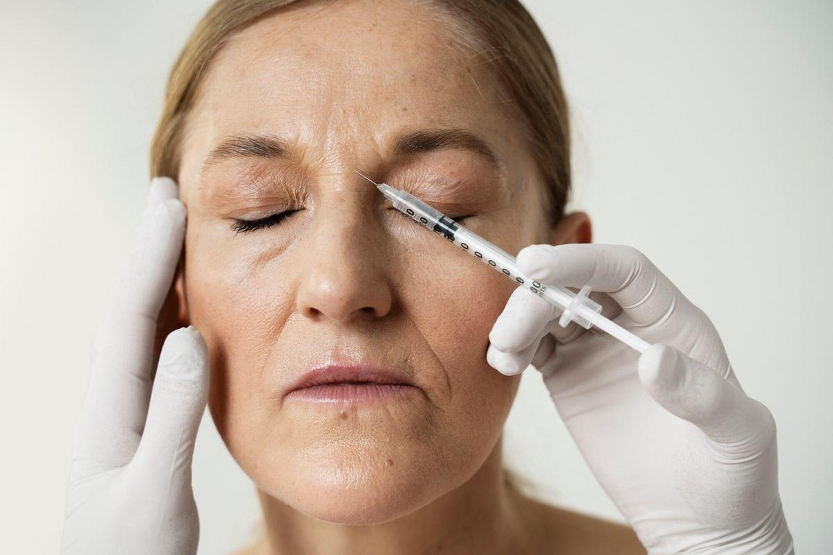 ภาพผิวหน้าหลังการฉีดสารเมพ Botox ช่วยลดริ้วรอย รายละเอียดเรียบหรู สวยเยิ้ม