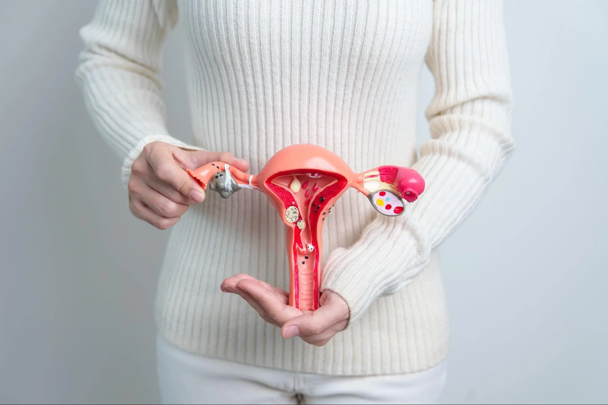 เนื้องอกมดลูก